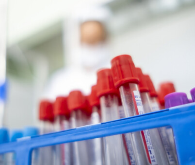 Full EPP (Hep B Titre, Measles, Rubella, Varicella, Hep B Ant, Hep C, HIV)