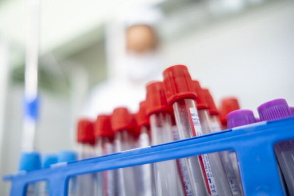 test tubes for placing blood