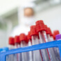 test tubes for placing blood