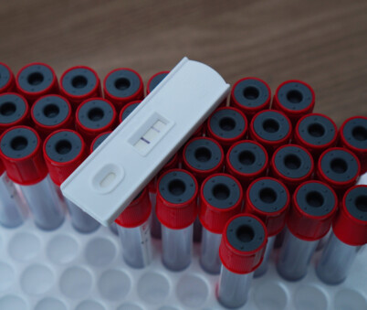 Hep B Ant (EPP)