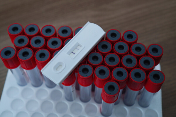 Hep B Ant (EPP)
