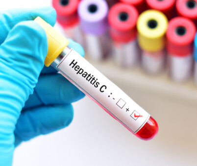 Hep C (EPP)