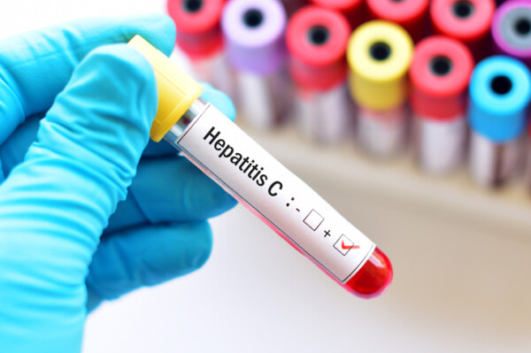 Hep C (EPP)