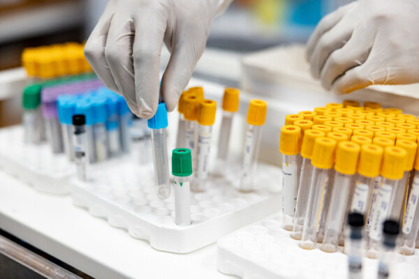 Close-up on a healthcare worker handling blood samples in the laboratory at the hospital
