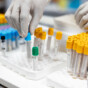 Close-up on a healthcare worker handling blood samples in the laboratory at the hospital