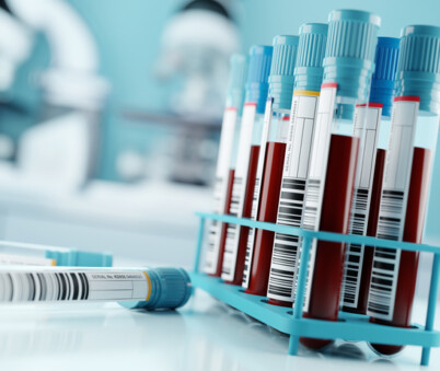 Non-EPP without Varicella (Hep B Titre, Measles, Rubella)