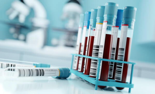 Non-EPP without Varicella (Hep B Titre, Measles, Rubella)