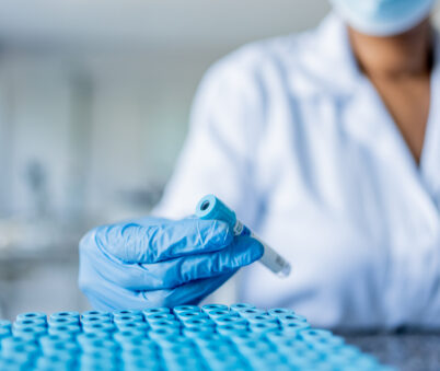 BCG QuantiFERON (The Doctors Laboratory)